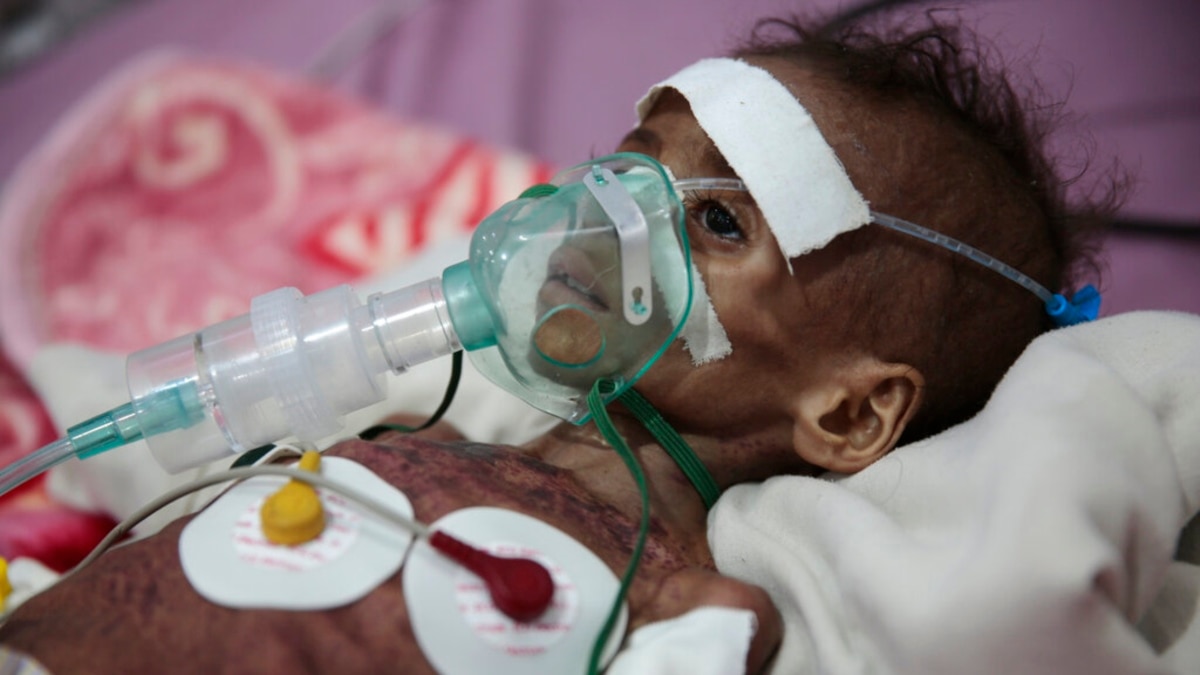 Ukraine War Worsens Already-Dire Humanitarian Crisis in Yemen